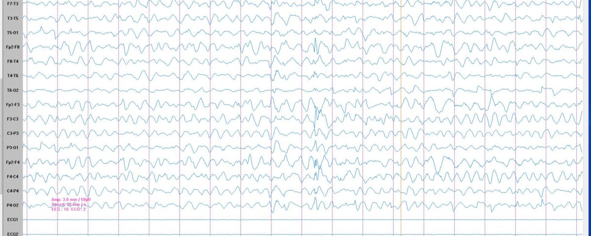 Case of the Month DRC